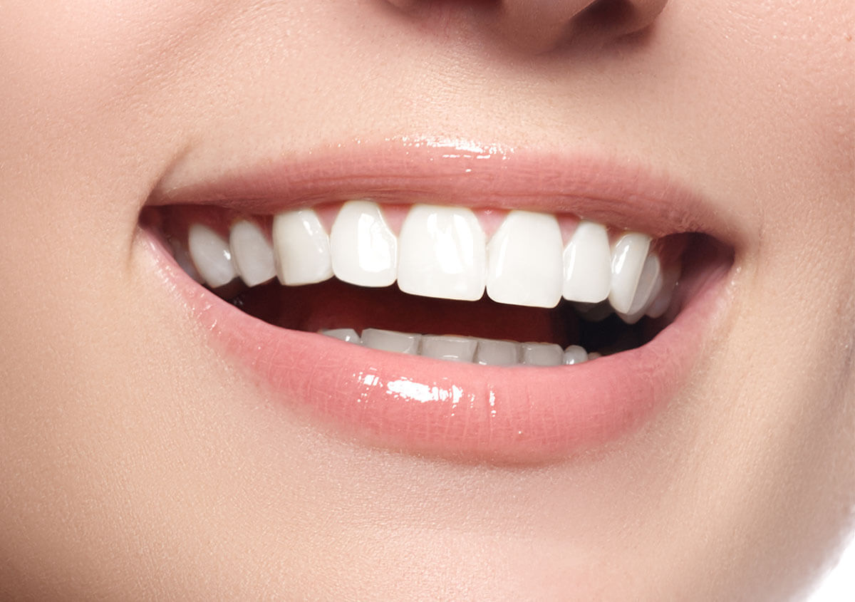 Cosmetic Teeth Whitening in Littleton CO Area
